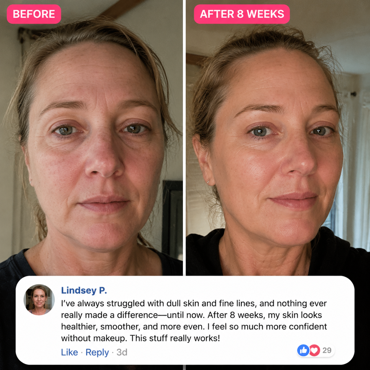 PDRN Collagen Volumizing Plump & Repair Balm