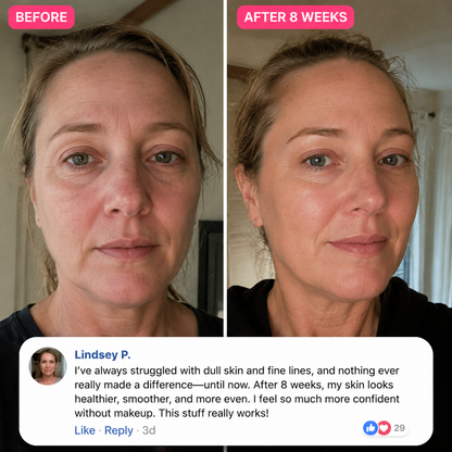 PDRN Collagen Volumizing Plump & Repair Balm