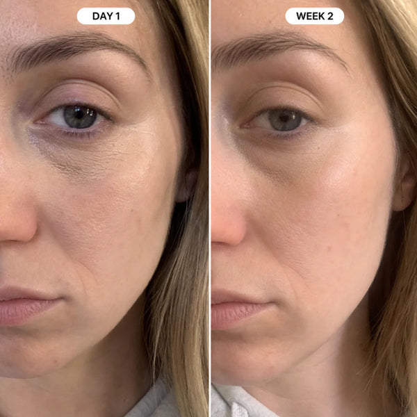 "My under-eyes don't look as empty anymore."