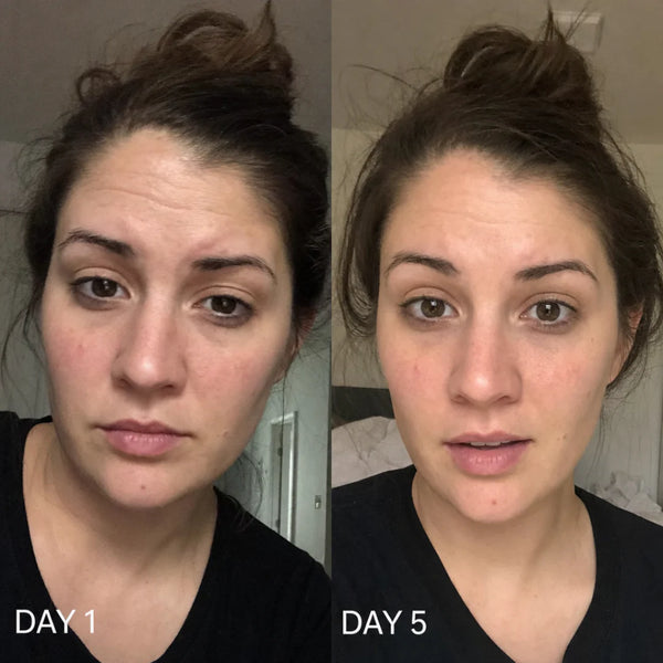 "I finally stopped obsessing over my smile lines."
